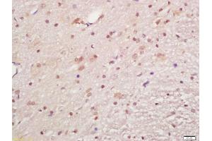 Formalin-fixed and paraffin embedded rat brain labeled with Anti-phospho-MAPKAPK5(Ser93)Polyclonal Antibody, Unconjugated (ABIN710561) at 1:200, followed by conjugation to the secondary antibody and DAB staining