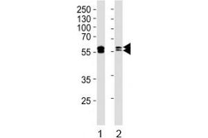Western blot analysis of lysate from 1) A431 and 2) Raji cell line using LYN antibody.