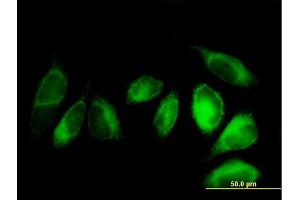 Immunofluorescence of purified MaxPab antibody to ALDH3A2 on HeLa cell. (ALDH3A2 anticorps  (AA 1-508))