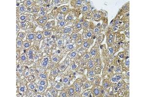 Immunohistochemistry of paraffin-embedded Mouse liver using CETP Polyclonal Antibody (CETP anticorps)