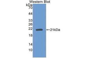 Western blot analysis of the recombinant protein. (GDF2 anticorps  (AA 241-418))