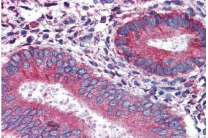 Human Uterus: Formalin-Fixed, Paraffin-Embedded (FFPE) (Calnexin anticorps  (AA 204-218))