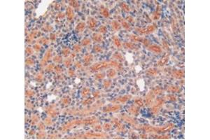 Detection of MMP12 in Rat Kidney Tissue using Polyclonal Antibody to Matrix Metalloproteinase 12 (MMP12) (MMP12 anticorps  (AA 20-99))