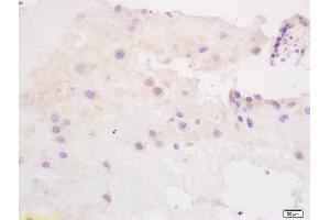 Formalin-fixed and paraffin embedded human placenta labeled with Anti SLC40A1/FPN1 Polyclonal Antibody, Unconjugated (ABIN1387819) at 1:200 followed by conjugation to the secondary antibody and DAB staining (SLC40A1 anticorps  (AA 331-430))