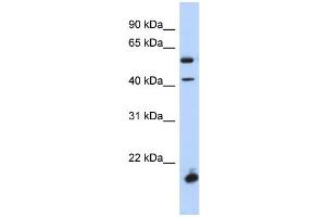 WB Suggested Anti-DBX1 Antibody Titration:  0. (DBX1 anticorps  (Middle Region))