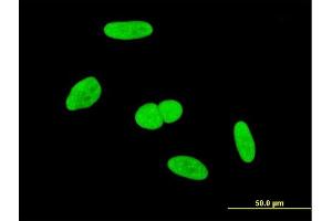 Immunofluorescence of monoclonal antibody to INTS6 on HeLa cell. (INTS6 anticorps  (AA 779-887))