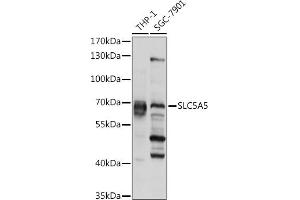 Western blot analysis of extracts of various cell lines, using SLC5 pAb (ABIN6127280, ABIN6148023, ABIN6148024 and ABIN6225047) at 1:1000 dilution. (SLC5A5 anticorps  (AA 544-643))