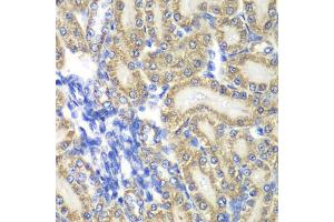 Immunohistochemistry of paraffin-embedded rat kidney using PTGES2 antibody (ABIN5974292) at dilution of 1/100 (40x lens). (PTGES2 anticorps)