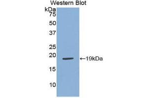 Western Blotting (WB) image for anti-Adrenomedullin (ADM) (AA 31-187) antibody (ABIN1172572) (Adrenomedullin anticorps  (AA 31-187))