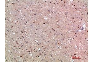 Immunohistochemical analysis of paraffin-embedded human-brain, antibody was diluted at 1:200