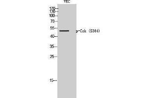 Western Blotting (WB) image for anti-C-Src tyrosine Kinase (CSK) (pSer364) antibody (ABIN3182195) (CSK anticorps  (pSer364))