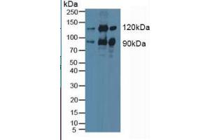 Rabbit Detection antibody from the kit in WB with Positive Control: Sample Lane1: Human Hela Cells; Lane2: Mouse Brain Tissue; Lane3: Porcine Brain Tissue.
