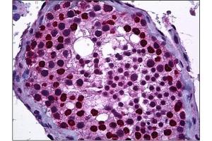 Human Testis: Formalin-Fixed, Paraffin-Embedded (FFPE)