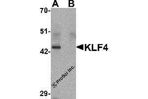 Western Blotting (WB) image for anti-Kruppel-Like Factor 4 (Gut) (KLF4) antibody (ABIN1031710) (KLF4 anticorps)