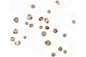 Immunocytochemistry of Paralemmin 3 in MCF7 cells withParalemmin-3 Cat.