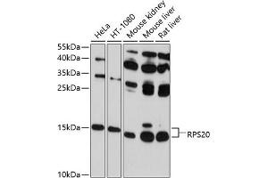 Western blot analysis of extracts of various cell lines, using RPS20 antibody (ABIN6129112, ABIN6147211, ABIN6147212 and ABIN6214592) at 1:1000 dilution. (RPS20 anticorps  (AA 1-119))