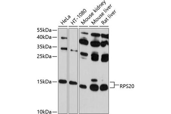 RPS20 anticorps  (AA 1-119)