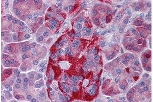 Human Pancreas: Formalin-Fixed, Paraffin-Embedded (FFPE) (EPHX4 anticorps  (AA 71-120))
