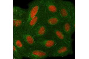 IF analysis of TOE1 using anti-TOE1 antibody (ABIN7601080) and anti-Tubulin Alpha antibody (ABIN7600339). (TOE1 anticorps  (AA 28-501))