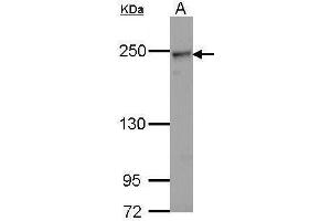 WB Image Sample (30 ug of whole cell lysate) A: Hela 5% SDS PAGE antibody diluted at 1:1000 (COL4a2 anticorps)