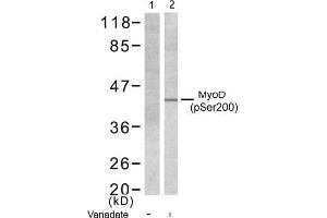 Image no. 1 for anti-Myogenic Differentiation 1 (MYOD1) (pSer200) antibody (ABIN196752) (MYOD1 anticorps  (pSer200))