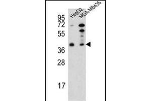 Western blot analysis of RP16 Antibody (C-term) (ABIN652189 and ABIN2840724) in HepG2,MDA-M cell line lysates (35 μg/lane). (PARP16 anticorps  (C-Term))