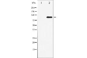 Western blot analysis of STAT3 expression in HeLa whole cell lysates,The lane on the left is treated with the antigen-specific peptide. (STAT3 anticorps  (C-Term))