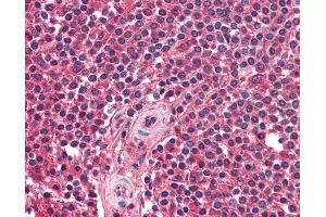 Anti-CXCR5 antibody IHC of human spleen. (CXCR5 anticorps)