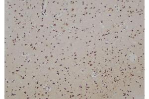 ABIN6274700 at 1/100 staining Human brain tissue by IHC-P.