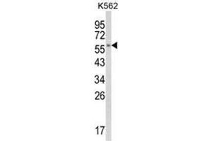 Western blot analysis of CYP8B1 Antibody (C-term) in K562 cell line lysates (35ug/lane).