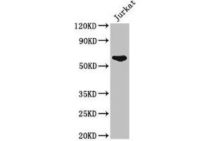 Western Blot Positive WB detected in: Jurkat whole cell lysate All lanes: UAP1 antibody at 2. (UAP1 anticorps  (AA 1-522))