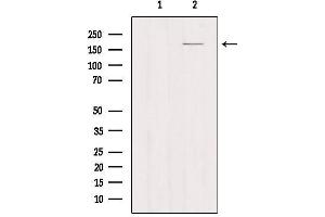 Western blot analysis of extracts from Myeloma cells, using MRC1 Antibody. (Macrophage Mannose Receptor 1 anticorps  (Internal Region))