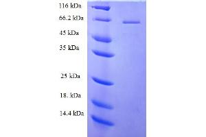 SDS-PAGE (SDS) image for Phospholipase C zeta 1 (PLCz1) (AA 1-415), (partial) protein (His-SUMO Tag) (ABIN5711471)
