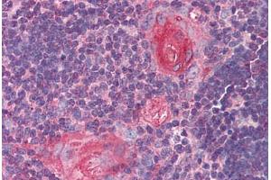 Human Thymus (formalin-fixed, paraffin-embedded) stained with SMC4 antibody ABIN290379 at 5 ug/ml followed by biotinylated goat anti-rabbit IgG secondary antibody ABIN481713, alkaline phosphatase-streptavidin and chromogen. (SMC4 anticorps  (AA 281-297))