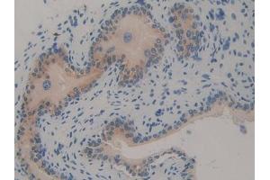 Detection of TRAF2 in Mouse Vas Deferens Tissue using Polyclonal Antibody to TNF Receptor Associated Factor 2 (TRAF2)