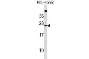 Western Blotting (WB) image for anti-Mannose-P-Dolichol Utilization Defect 1 (MPDU1) antibody (ABIN3001379) (MPDU1 anticorps)