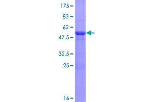 Image no. 1 for HECT Domain Containing 2 (HECTD2) (AA 1-207) protein (GST tag) (ABIN1306507)