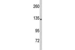 Western blot analysis of C5 antibody and HL-60 lysate