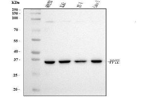 Western blot analysis of Cyclophilin E/PPIE using anti-Cyclophilin E/PPIE antibody (ABIN7599242). (PPIE anticorps  (AA 1-301))