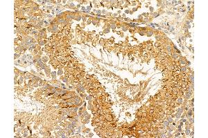 ABIN6263618 and ABIN6267044 at 1/100 staining Rat testis tissue by IHC-P.