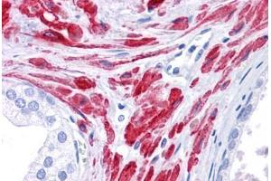 Human Prostate: Formalin-Fixed, Paraffin-Embedded (FFPE)