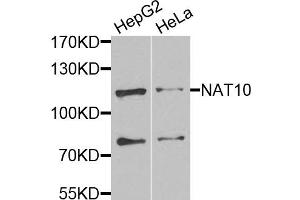 Western blot analysis of extracts of various cell lines, using NAT10 antibody. (NAT10 anticorps)