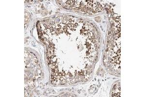 Immunohistochemical staining of human testis with C6orf118 polyclonal antibody  shows strong cytoplasmic positivity in subsets of seminiferus duct cells at 1:50-1:200 dilution. (C6ORF118 anticorps)