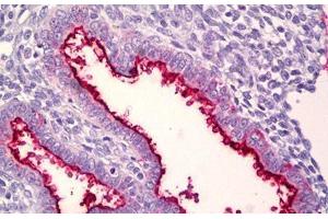 Anti-MUC16 / CA-125 antibody IHC staining of human uterus, endometrium. (MUC16 anticorps  (AA 13311-13360))