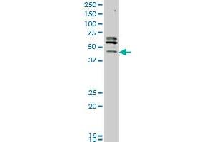 STK32C monoclonal antibody (M05), clone 3E8 Western Blot analysis of STK32C expression in MCF-7 . (STK32C anticorps  (AA 1-369))