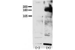 Western blot testing of phospho-ERBB4 antibody and FG pancreatic carcinoma cells treated with or without EGF (50ng/ml) for 15 min.