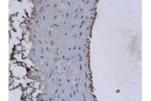 Formalin-fixed and paraffin embedded Rabbit Cartoid labeled with Anti-PAFAH2/Lp-PLA2 Polyclonal Antibody, Unconjugated (ABIN686722) followed by conjugation to the secondary antibody and DAB staining