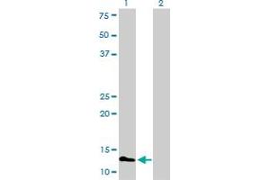 Western Blot analysis of FABP3 expression in transfected 293T cell line by FABP3 monoclonal antibody (M01), clone 4F6-1D6.