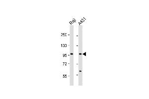 All lanes : Anti-NFKB1 Antibody  at 1:1000 dilution Lane 1: Raji whole cell lysate Lane 2: A431 whole cell lysate Lysates/proteins at 20 μg per lane.