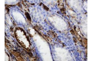 Image no. 6 for anti-Thymidine Phosphorylase (TYMP) (AA 311-482) antibody (ABIN1491396)